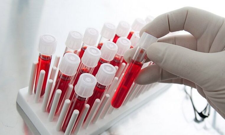 sangue en tubos de ensaio para a análise dun can con prostatite